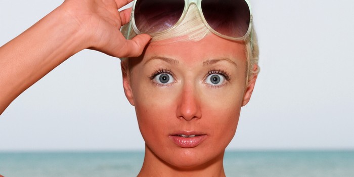 9 способов скрыть следы солнечных ожогов и быстро восстановить кожу 