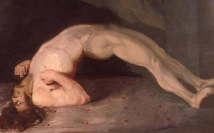 Столбняк Столбняк