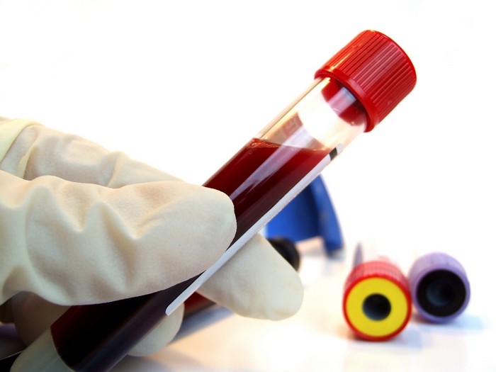 Искусственная кровь от ученых из Эдинбургского университета Искусственная кровь от ученых из Эдинбургского университета