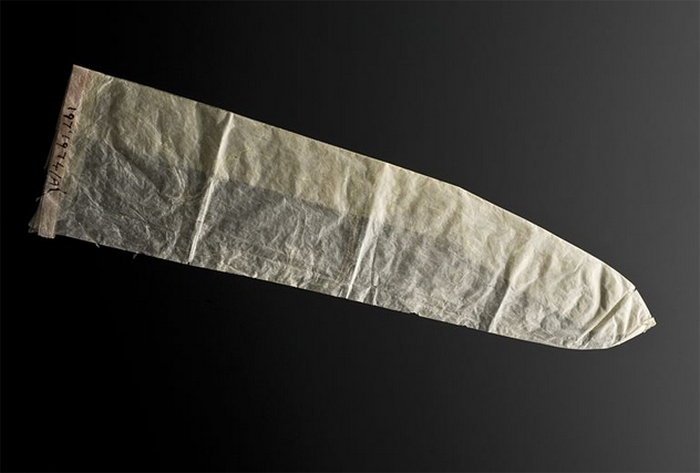 Мочевой пузырь. Мочевой пузырь.