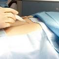 Высокотехнологичный скальпель анализирует ткани прямо во время операции