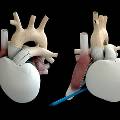 Изобретатели представили полноценно работающее синтетическое сердце