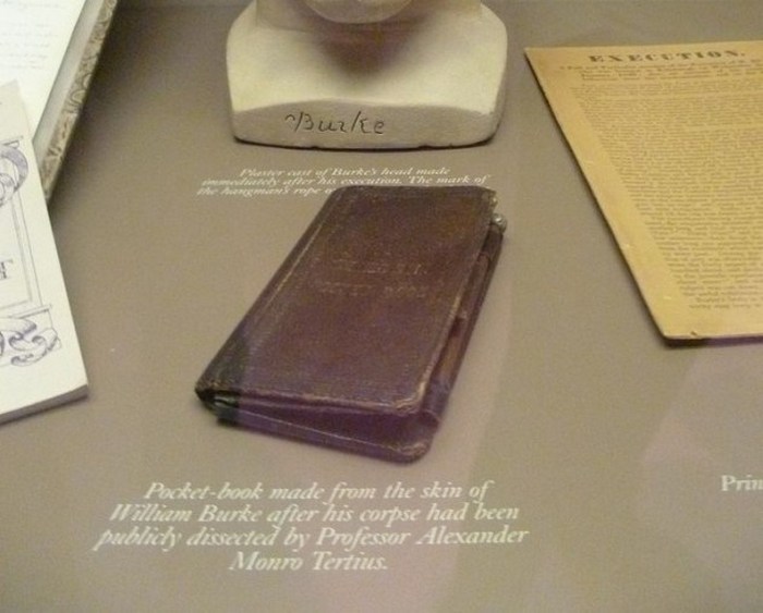 Книга из человеческой плоти (Хирургический музей патологий, Эдинбург, Шотландия)