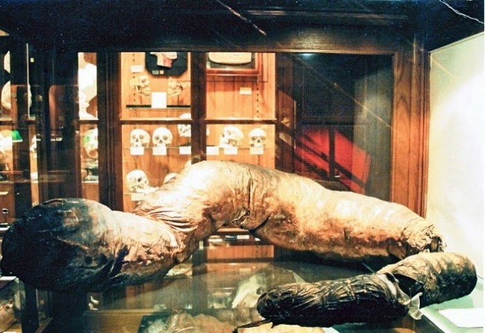 Гигантская толстая кишка (Музей Мюттер, Филадельфия, США)