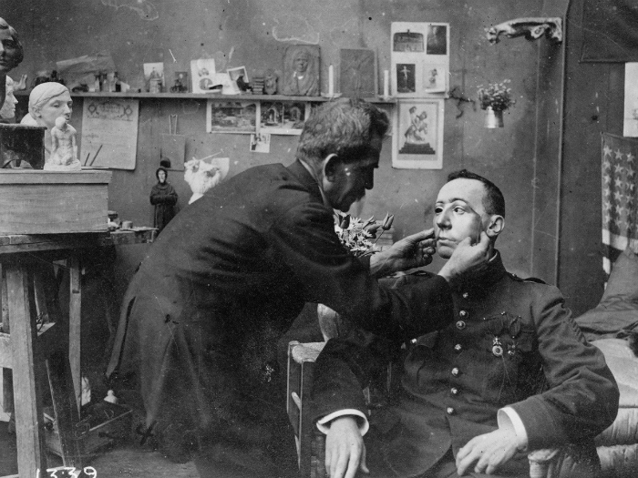 1918 год. Солдат, чье лицо сильно пострадало в Первой мировой войне примеряет маску, сделанную Красным Крестом.